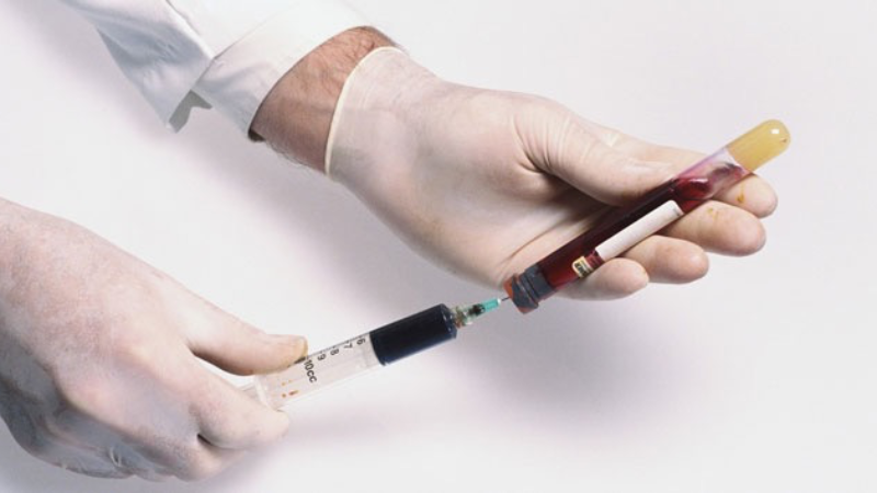 Hepatit B, siroz ve karaciğer kanseri riskini artırıyor