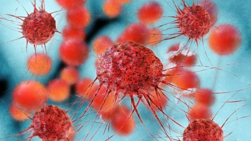 Meme kanserinde erken teşhiste radyolojinin gücü